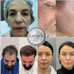 lunaris-klinika-ukraina-Copy-3.jpg